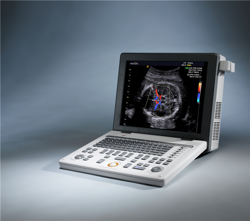 三星麥迪遜便攜彩超SONOACE R3