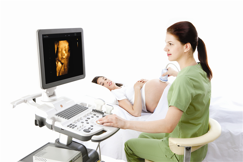 三星麥迪遜彩超SonoAce R7