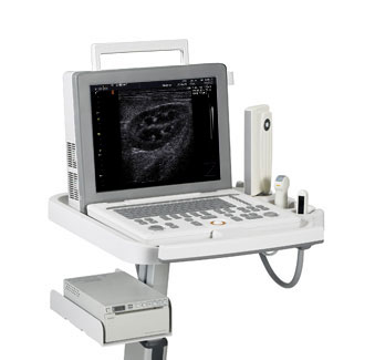 三星麥迪遜Sonovet R3超聲