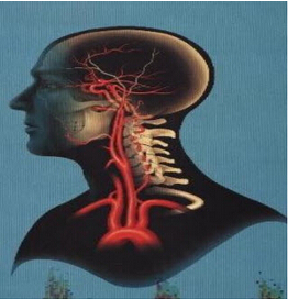 德國經顱多普勒檢測分析系統（TCD） DWL