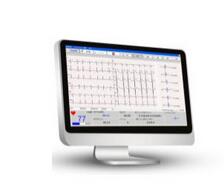 心電工作站(運動心電測試系統)ST-1212