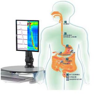 胃腸動力學檢查系統 Solar GI