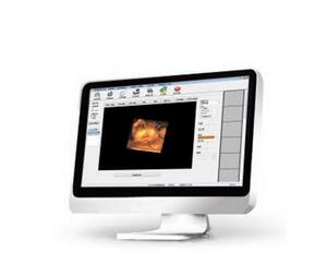 超聲影像管理系統 MG系列