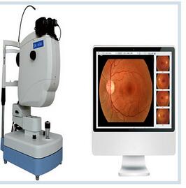 眼底照相機 SK-550A