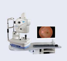 眼底熒光造影 APS-CER