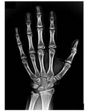 數(shù)字X光骨齡機(jī) AMW HB-101