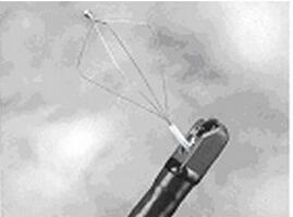 大鉗道 廣角 頭端射水裝置 治療型 ED-450XT5