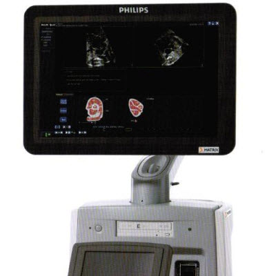 飛利浦超聲診斷系統(tǒng)IU ELITE