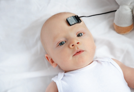 無線便攜式近紅外成像系統 PortaLite