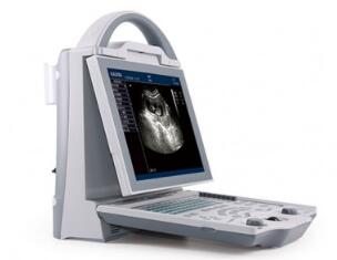 KX5600 便攜B超機