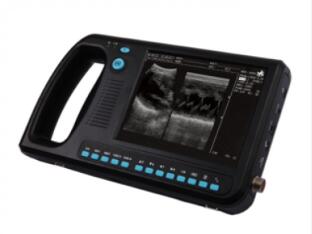 威爾德wed-3000掌上全數(shù)字超聲診斷系統(tǒng)