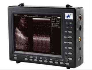 威爾德wed-2000a掌上全數(shù)字超聲診斷系統(tǒng)
