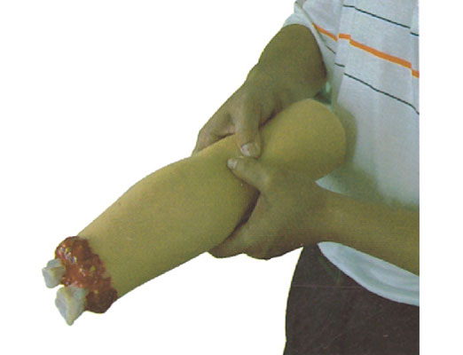 上肢外傷斷肢止血模型?KAS/H2008