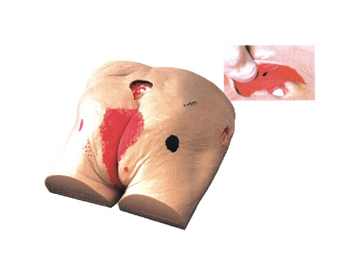  老年人褥瘡（壓瘡）護理模型?KAS-RC-2