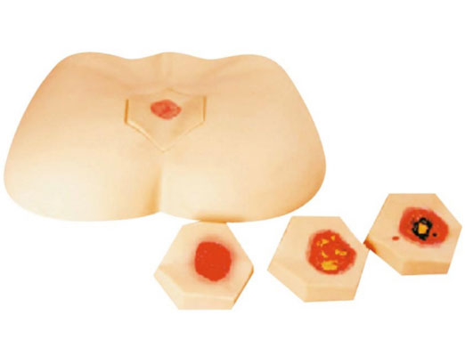  階段褥瘡護理模型KAS-RC-3?