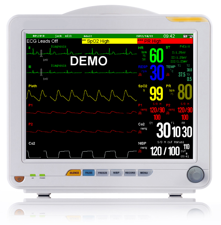 SPR9000A 便攜式多參數監護儀