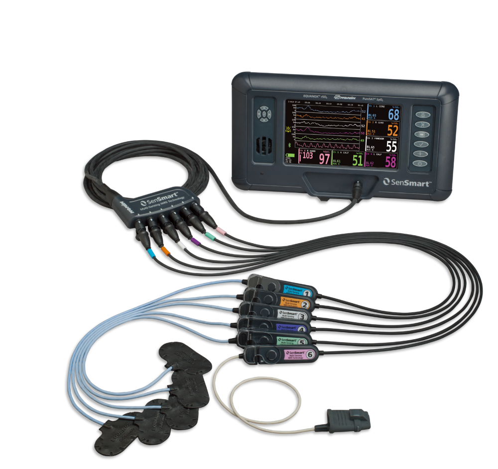 腦部與組織氧飽和度監(jiān)護儀