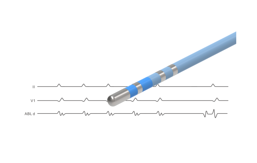 NAVABLATOR? 心臟射頻消融導(dǎo)管