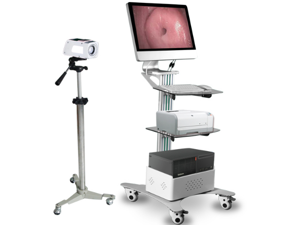 愛給力SW-3302數字光學陰道鏡