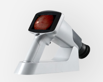 美沃手持式眼底照相機(jī)FC161