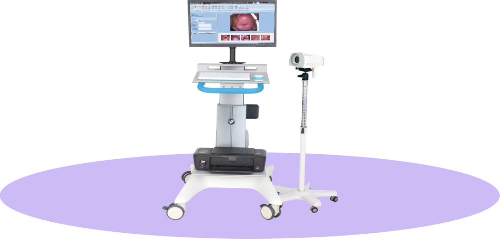 經典款 數碼電子陰道鏡