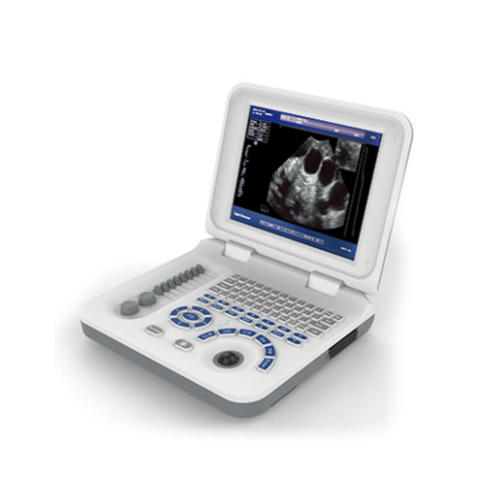 先鋒全數(shù)字筆記本式動(dòng)物超聲診斷儀 V-30