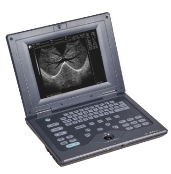 威爾德筆記本全數字超聲診斷系統WED-2018