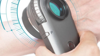 ILLUCO IDS 1100 手持式便攜皮膚鏡