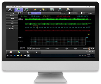 光電中央監(jiān)護(hù)工作站.png 光電中央監(jiān)護(hù)工作站.png