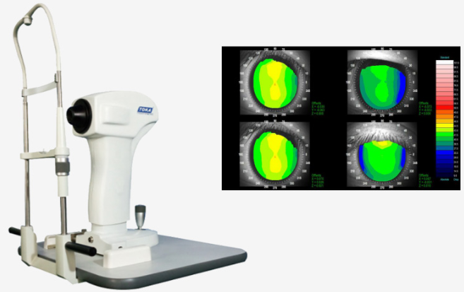 雷蒙光電角膜地形圖 CT-6