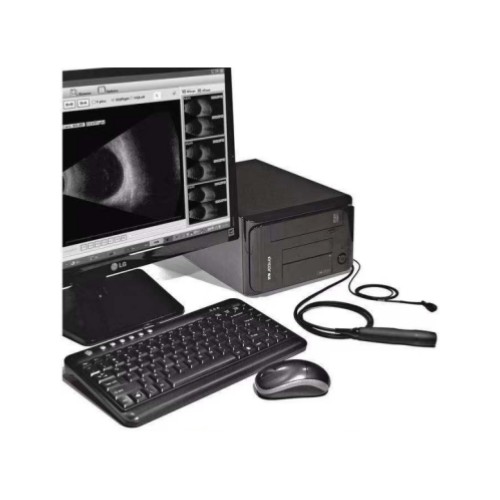 索維眼科AB超眼科超聲診斷