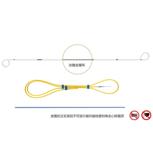優(yōu)泰輸尿管支架(內(nèi)置金屬)