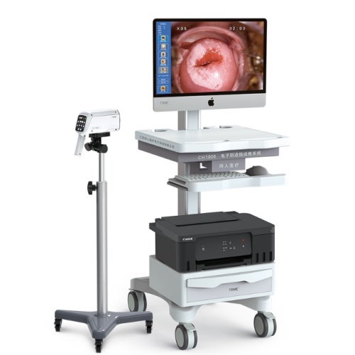 同人電子陰道鏡成像系統CH1000