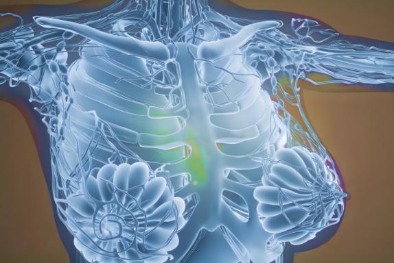 乳腺彈性成像準確嗎 乳腺彈性成像準確嗎