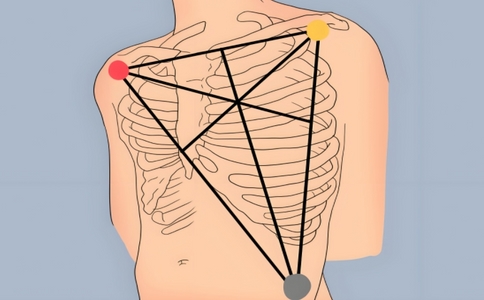 動態心電圖7個位置.jpg 動態心電圖7個位置.jpg