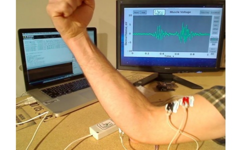 肌電圖