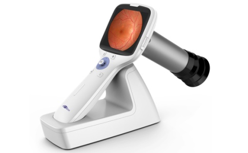 新眼光便攜眼底相機NES-1000P