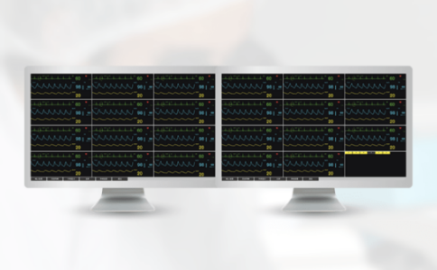 華聲中央監(jiān)護系統(tǒng)WCMS-88