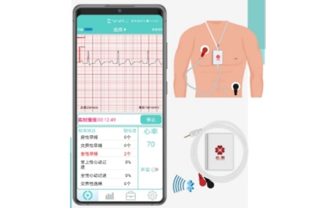 動態心電 動態心電