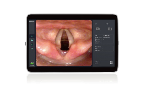 內窺鏡圖像處理器