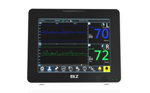 博聯(lián)眾科腦組織氧飽和度監(jiān)測(cè)儀MOC100