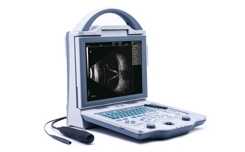 超聲診斷儀 超聲診斷儀