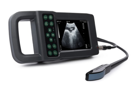 超聲診斷儀 超聲診斷儀
