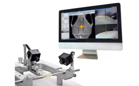 全自動(dòng)腦立體定位儀