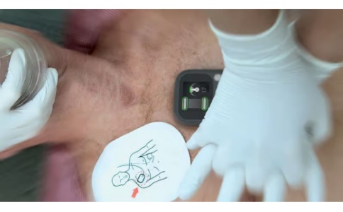 挪度心肺復(fù)蘇術(shù)反饋CPRmeter? 2